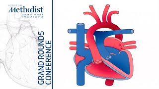 Approach to Heart Failure in the Adult with CHD (Laith Alshawabkeh, MD) October 10, 2019