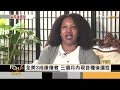 新冠輕症痊癒者也難逃 後遺症廣泛難測｜方念華｜focus全球新聞 20220503