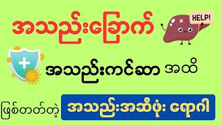 အသည်းအဆီဖုံး ရောဂါအကြောင်း - fatty liver