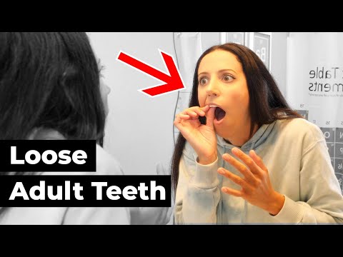 What happens if your tooth is Wiggly?