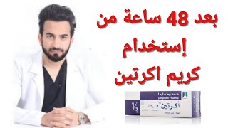 طريقة استخدام اكرتين لعلاج حب الشباب Acretin cream- دكتور طلال المحيسن