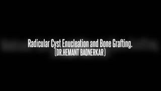 Radicular Cyst Enucleation and Bone Grafting by Dr.Hemant Baonerkar