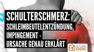 Schulterschmerz: Schleimbeutelentzündung, Impingement: Orthopäde erklärt genau!