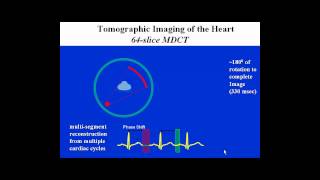 CCTA Training Lecture 1B Temporal and Spatial Resolution in Cardiac CT