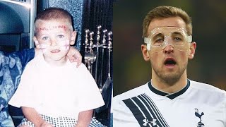 Harry Kane Transformation Then & Now (Body & Hairstyle & Tattoos)
