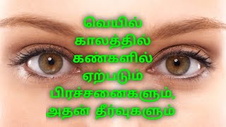 Summer eye care tips in Tamil || வெயிலில் இருந்து உங்கள் கண்களை பாதுகாக்க || 3RosesLifeStyle