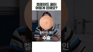 툭 튀어나온 '켈로이드 흉터' 이렇게 치료하면 됩니다 #shorts