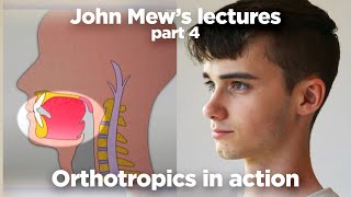 John Mew's lectures part 4: Stanley's case
