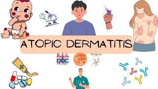 Atopic dermatitis - Eczema (Dermatology) | Medvidsmadesimple