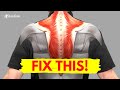 How to Fix Muscle Knots in Your Neck and Shoulder in 30 SECONDS