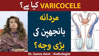Varicocele Ka Ilaj | Varicocele Treatment at Home in Urdu/Hindi | How To Cure Varicocele?