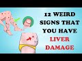 Warning: 12 Weird Signs That Show You're Having Liver Damage