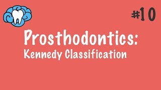 Prosthodontics | Kennedy Classification | INBDE, ADAT
