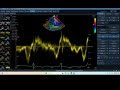 IQ 217 MV E' TVI MEASUREMENT ECHOPAC ANALYSIS ECHOCARDIOGRAPHY