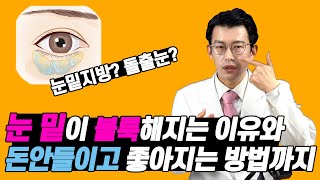 Why are my under-eyes fat? How to Remove Eye bags 눈밑이 불룩해지는 이유와 돈안들이고 좋아지는 방법까지!- 눈밑지방? 돌출눈?