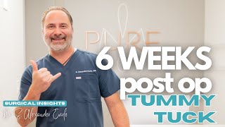 Radiant Renewal: Six Weeks After a Tummy Tuck