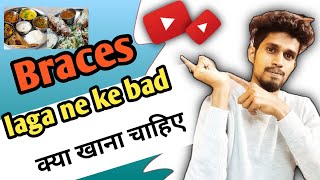 Braces laga ne ke bad kiya khayen|ब्रेसिज़ लगाने के बाद कोया खायें|What to eat after getting braces🧐