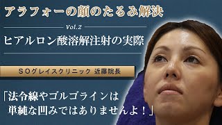 「アラフォーの顔のたるみ解決」vol.2 ヒアルロン酸溶解注射の実際