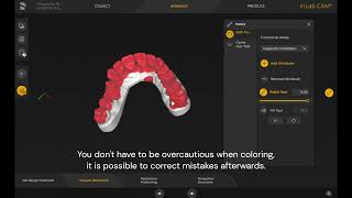 How to mark support forbidden regions in inLab CAM