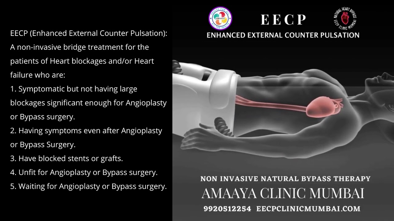 What Is EECP NonInvasive Bypass Therapy? Enhanced External ...