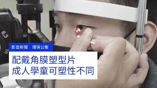 配戴角膜塑型片 成人學童可塑性不同｜小世界周報｜世新大學新聞學系