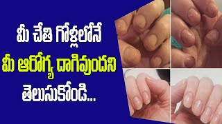 మీ చేతి గోళ్ల లోనే మీ ఆరోగ్యం దాగిఉంది |10 Nail Signs of Health Problems || Arogya Balam