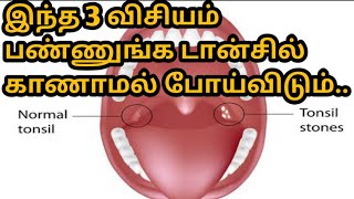 டான்சில் குணப்படுத்துவது இவ்வளவு சுலபமா?இப்படி சாப்பிட்டால் போதும்...//one day vlog