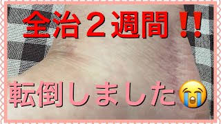 急遽動画を作りました。怪我をして1週間🤕