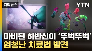 [자막뉴스] 마비된 다리가 '세상에'...죽은 신경세포 살린 치료법 / YTN