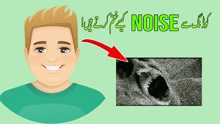 Image Denoising using Python Script | Python Automation Projects #pythonautomation #pythoninhindi