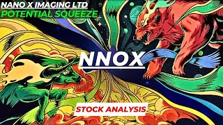 POTENTIAL SQUEEZE | $NNOX STOCK ANALYSIS | NANO X IMAGING LTD STOCK