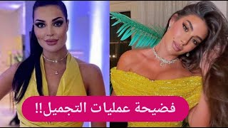 شاهدوا نادين نجيم تقلد ياسمين صبري  ترسم على ابو هشيمة ؟!!