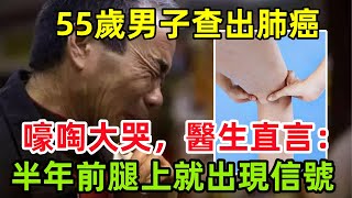 55歲男子查出肺癌，嚎啕大哭，醫生直言：半年前腿上就出現信號#健康常識#養生保健#健康#健康飲食