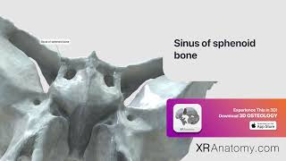 Sinus of sphenoid bone of sphenoid bone