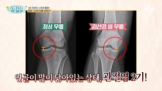 다리 길이가 다르다?! 골반이 틀어진 채 살아가는 의뢰인의 관절 상태 | 순정시대 58 회