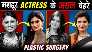 Famous ACTRESSES के असली चेहरे जो 99% लोग नहीं जानते | SHOCKING Plastic Surgery Of Famous Actresses