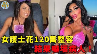 澳洲女護士花120萬整容，自稱「限量版芭比娃娃」，結果嚇壞病人！｜整容｜真人芭比｜明星觀察員