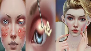ASMR# animation |  remove blackheads from nose | ASMR Stop Motion