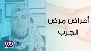 أعراض مرض الجرب وعلاجه