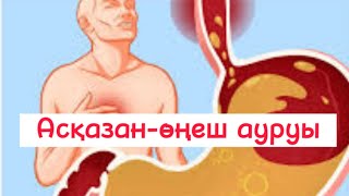 ГЭРА белгілері. Асқазан өңеш рефлюксі ауруының белгілері. Изжога, Отрышка белгілері