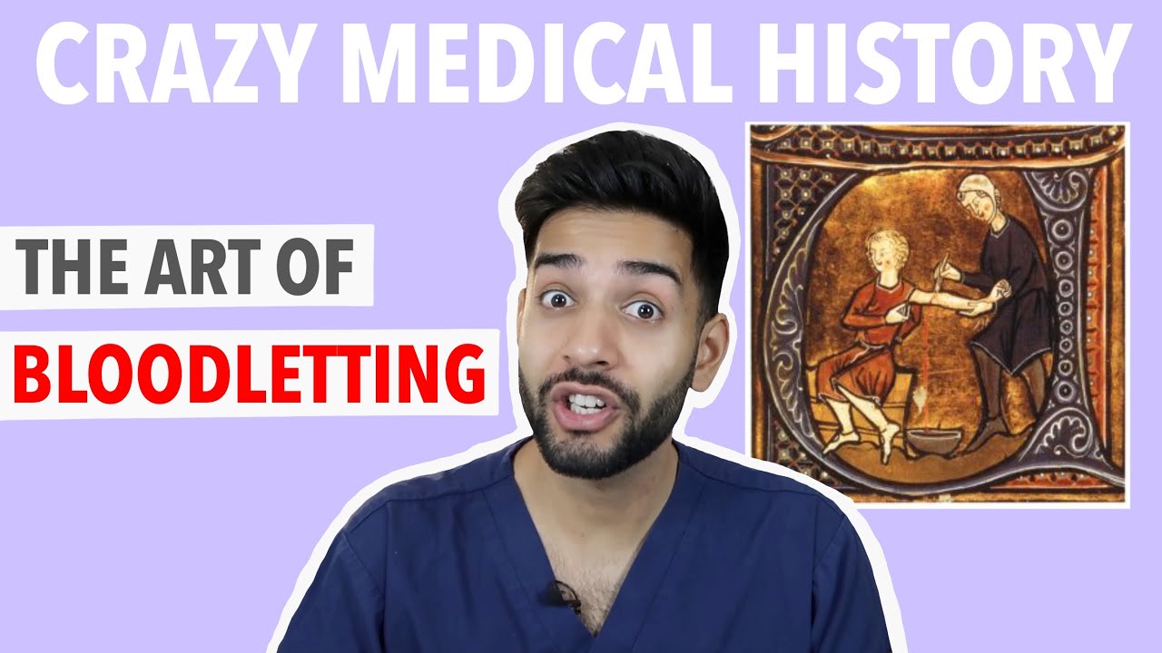 BLOODLETTING - The 3000 Year Old Medical Practice Doctors STILL Use ...