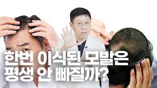 이식된 머리카락이 새로운 자리에서 생착되는 신기한 과정!_[루트모발이식]