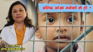 के हो अल्छी आँखा ? कारण, लक्षण र उपचार यस्ता छन् | Nepali Health Tips | Doctor Saathi