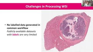Computational Pathology: Supervised versus Unsupervised Learning