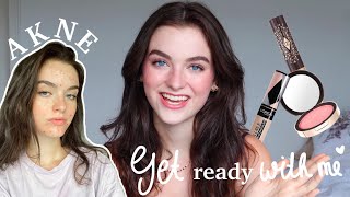 Wie ich meine Akne abdecke…get ready with me✨ | Fabienne Bethmann