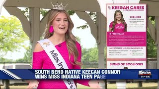 South Bend native wins Miss Indiana Teen; advocates for scoliosis awareness