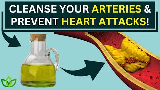Cleanse Arteries and Prevent Heart Attack with These 12 Natural Foods