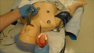 Mac Blade Intubation Part 1 (Background Knowledge)