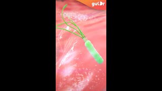 What is Gastritis and H. Pylori? | 3D #Shorts