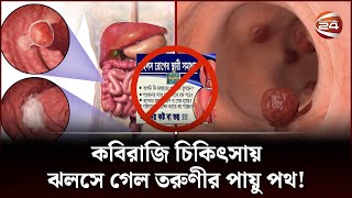 কবিরাজি চিকিৎসায় ঝলসে গেল তরুণীর পায়ু পথ! | Piles Treatment | Channel 24